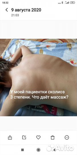Профессиональный массаж
