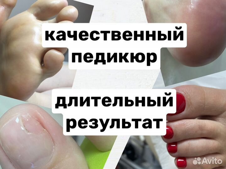 Мастер педикюра, подолог, Люберцы, Жулебино