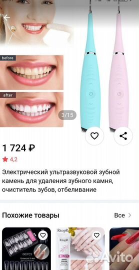 Ультразвуковое удаление зубного камня