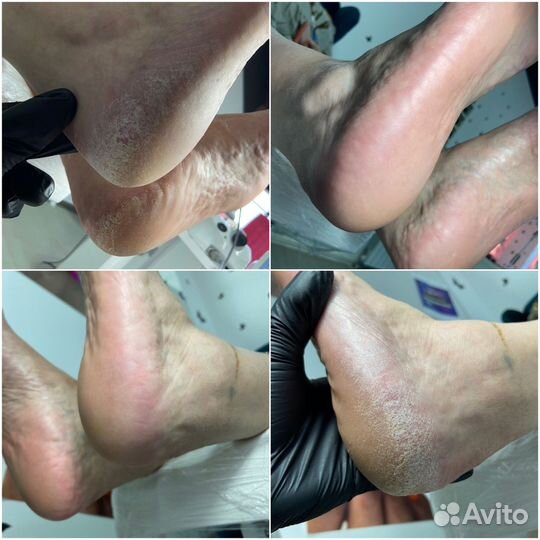 Маникюр педикюр