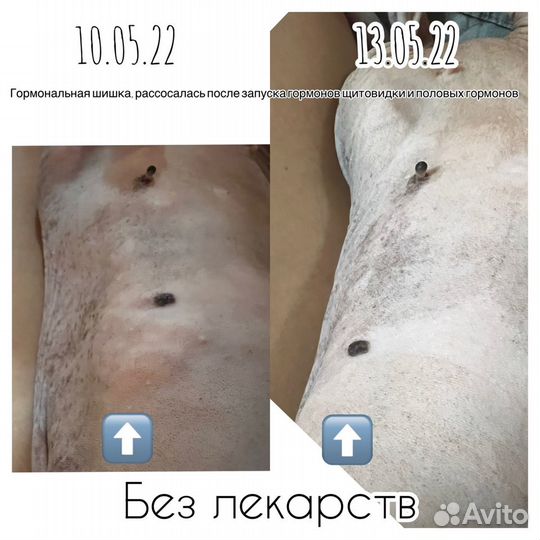 Энергетический массаж Access bars/ Аксесс барс