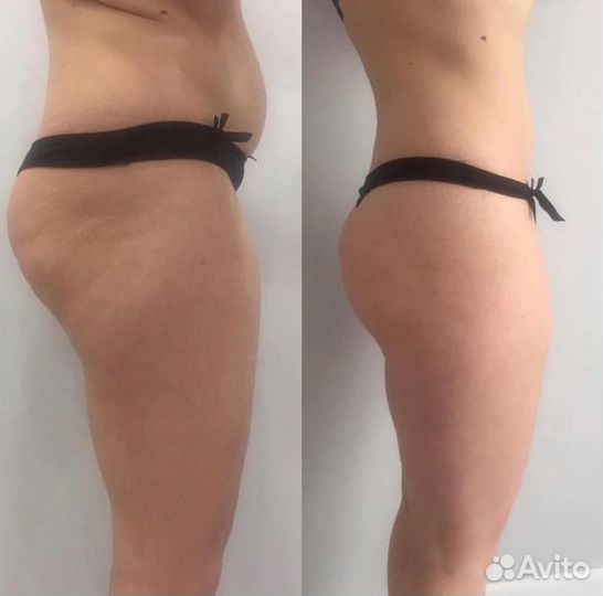 Профессиональный массажист