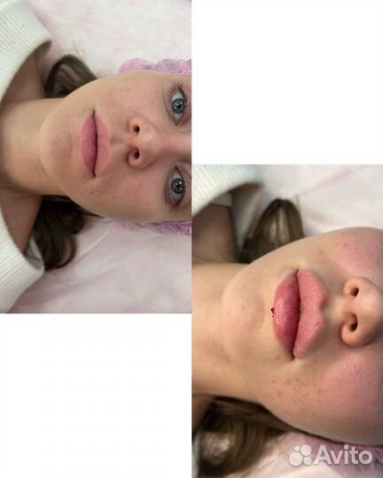 Услуги косметолога