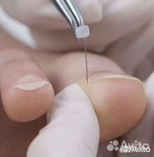 Подолог / Медицинский педикюр и маникюр