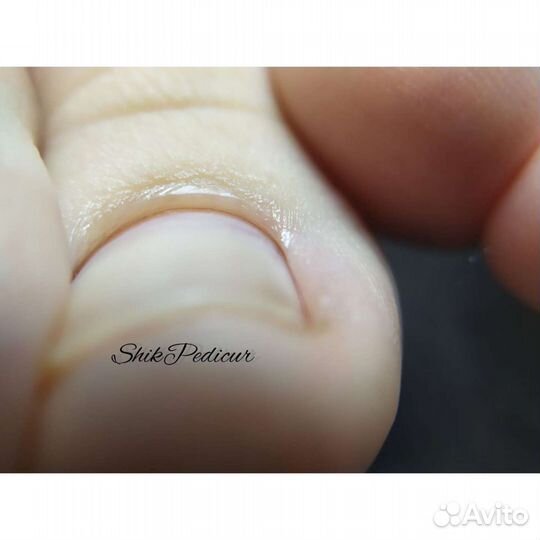 Подология/Педикюр/Чита