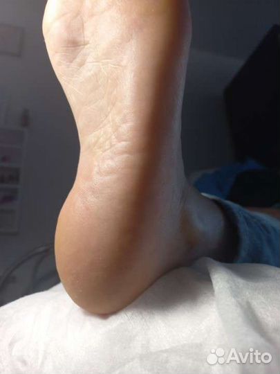 Педикюр,обработка стоп