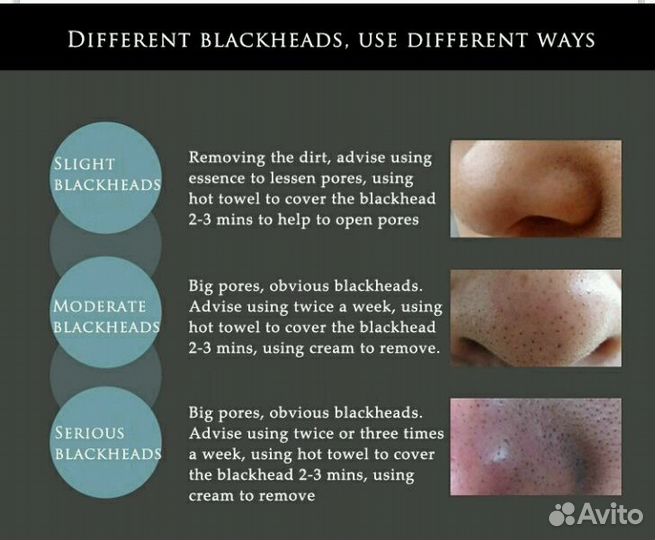 Маска для лица от чёрных точек Bioaqua