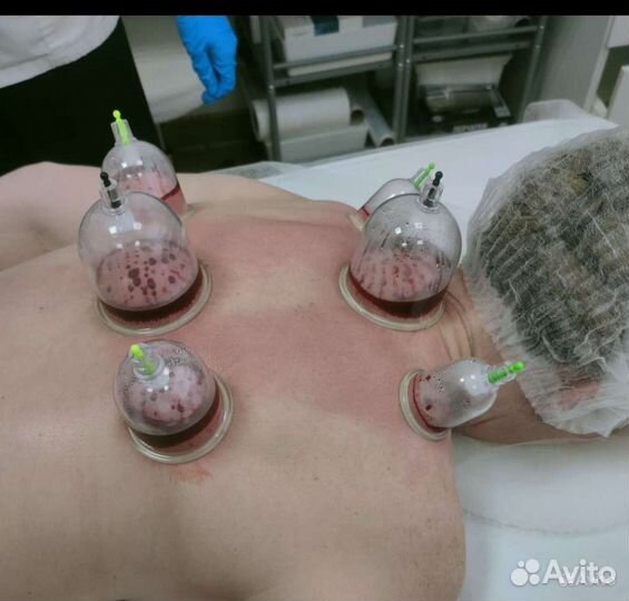 Хиджама банки