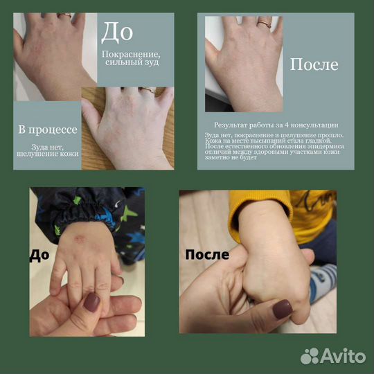 Консультация психолога