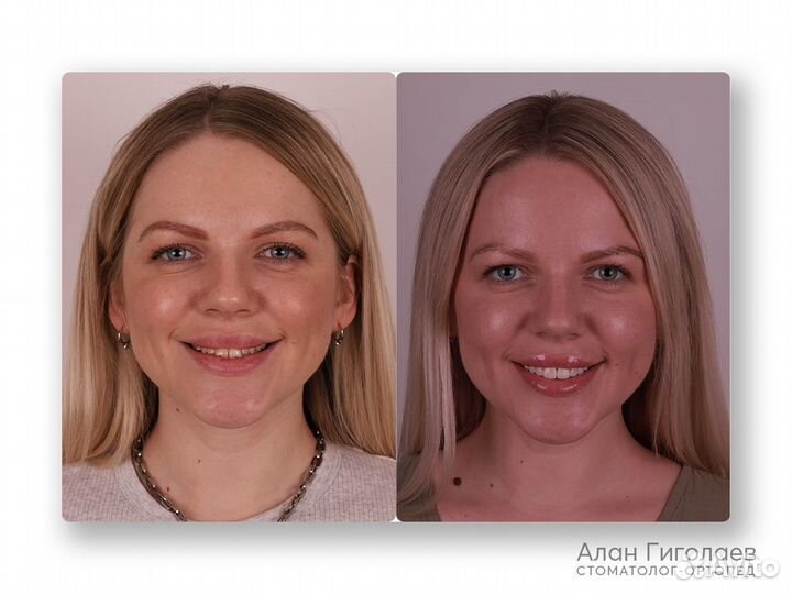 Профессиональная гигиена