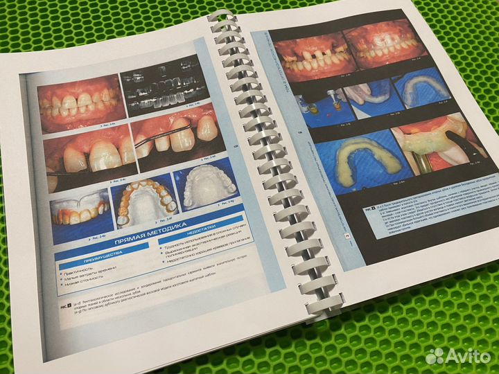 Анализ эстетики Том 2