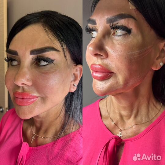 Услуги косметолога