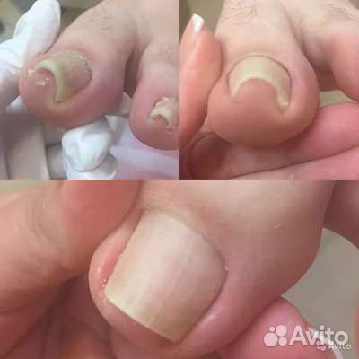 Услуги подолога