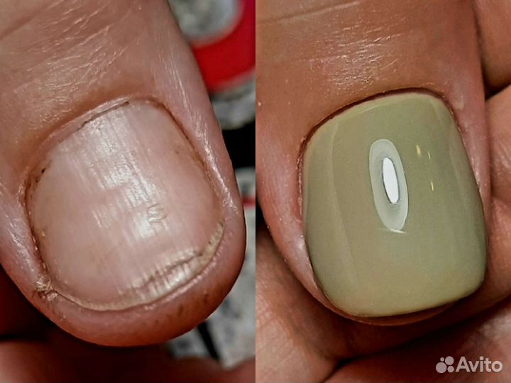 Маникюр на дому