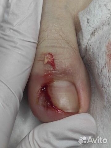 Услуги подолога