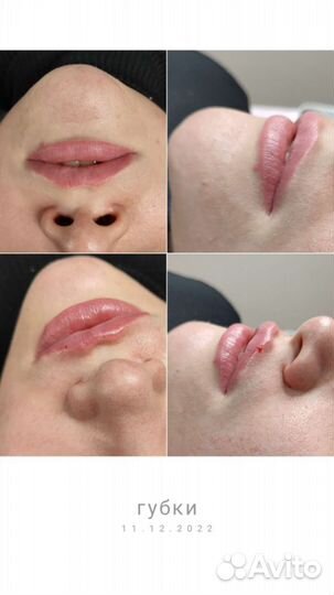 Услуги косметолога