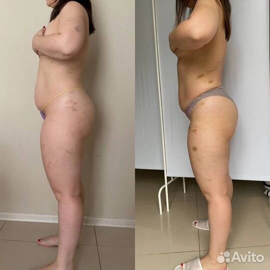 Модель на массаж