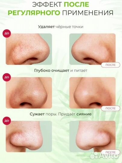 Lanbena Маска от черных точек на лице