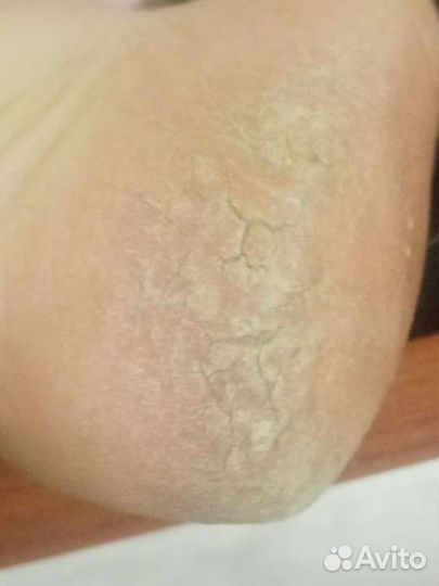 Педикюр,обработка стоп