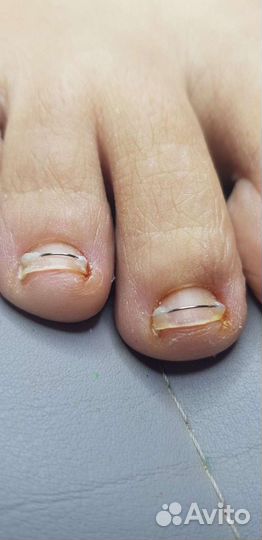 Услуги подолога