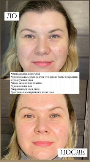 Массаж лица и тела face.embrace.spb