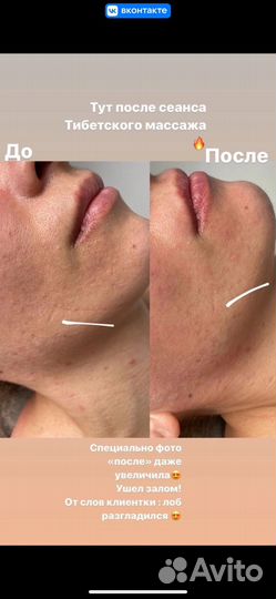 Массаж лица и тела