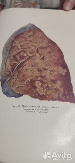 Опыт советской медицины