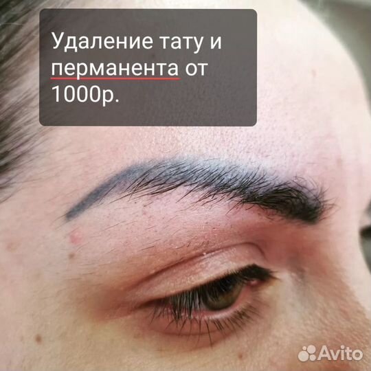 Увеличение губ