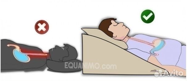 Подушка клиновидная при рефлюксе эзофагите