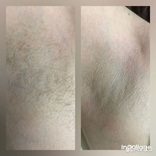 Мастер шугаринга и восковой депиляции