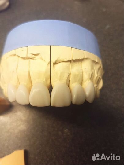 Зубной техник керамист