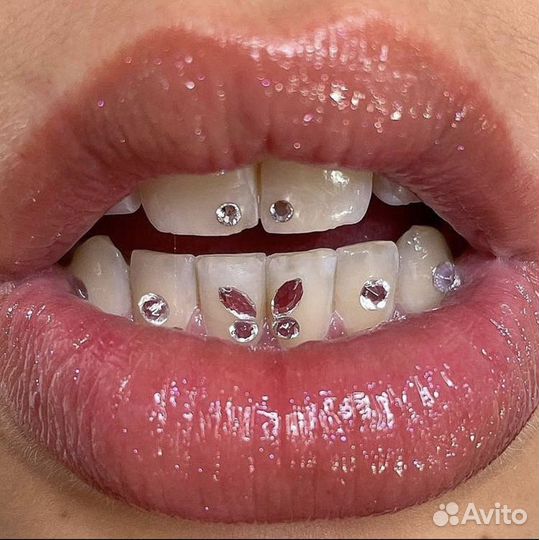 Установка Скайс