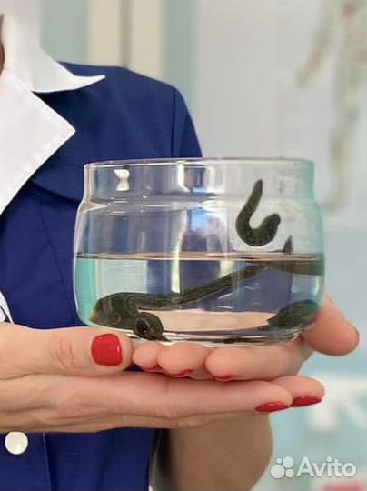 Купон на гирудотерапию