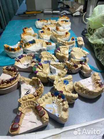 Зуботехническое литьё (литейщик)