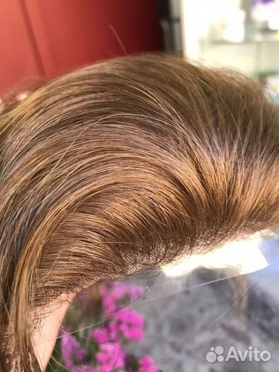 Система замещения волос