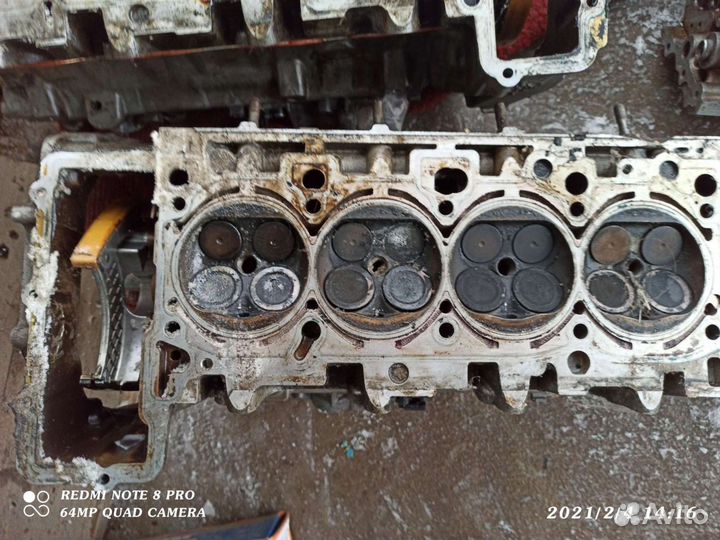 Гбц левая правая,и многое другое