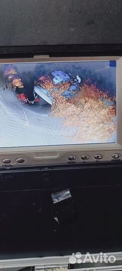 Устранение засоров,эндоскоп