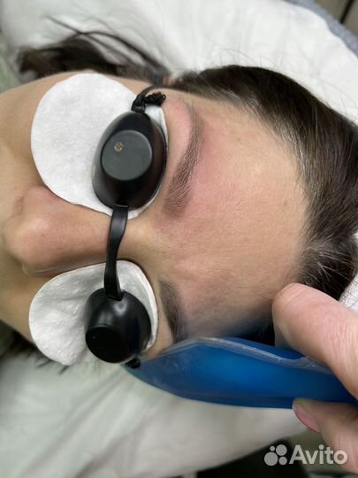 Удаление татуажа,тату лазером,ремувером