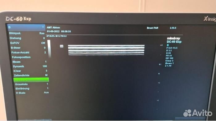 Узи аппарат Mindray DC-60 Exp X-Insight