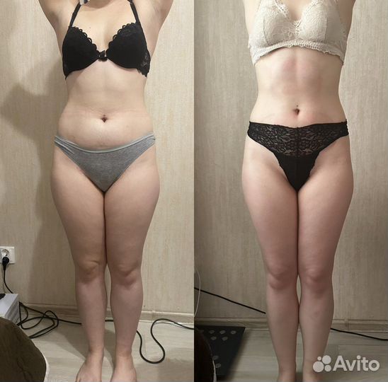 Услуга «лежи И худей»