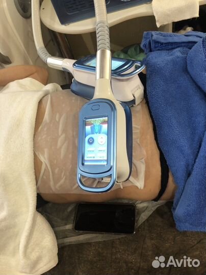 Процедура криолиполиз