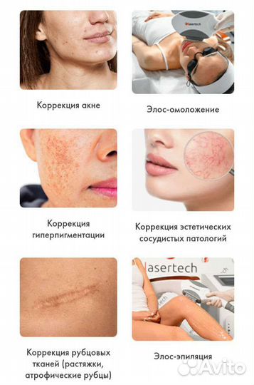 Lasertech elos Compact