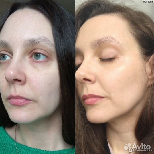 Тренажер для мышц лица и шеи