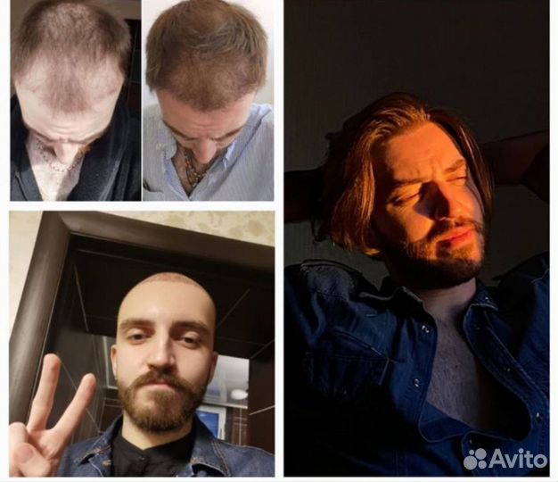 Лечение волос