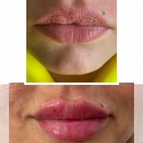 Косметология. Full Face, Софрино