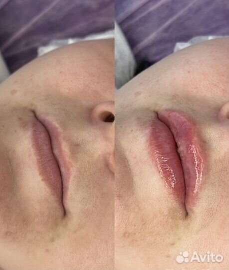 Услуги косметолога