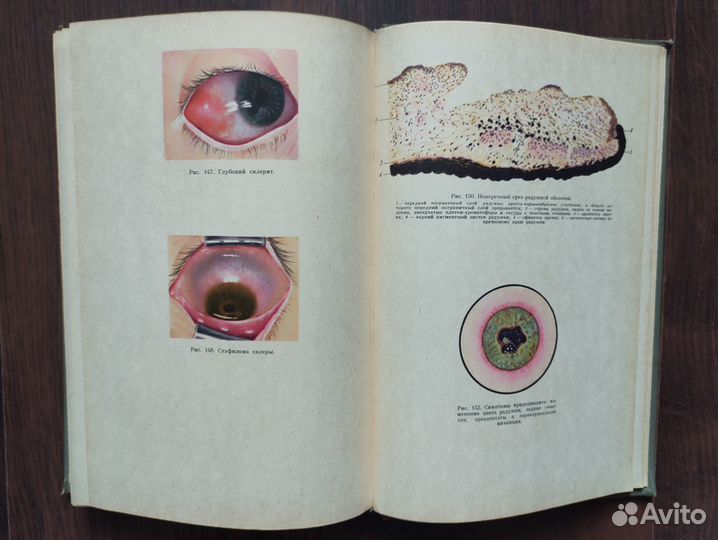 В.Н.Архангельский Е.И. Ковалевский Глазные болезни