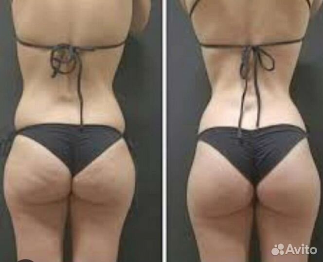 Коррекция фигуры