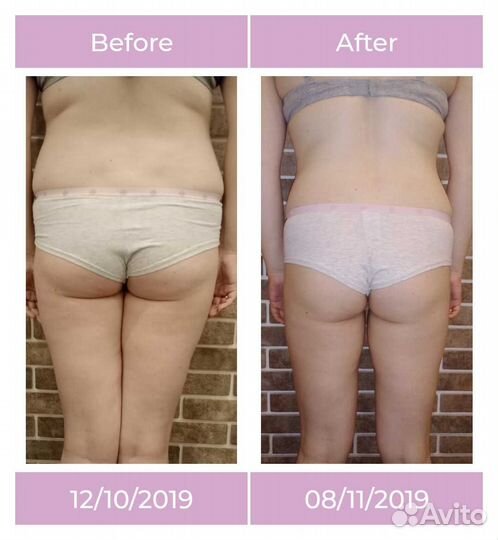 Массаж/коррекция фигуры/массаж лица/уз чистка