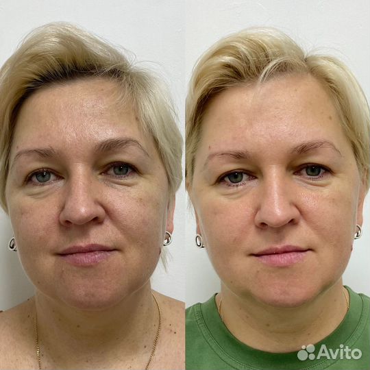 Косметолог Красноармейский